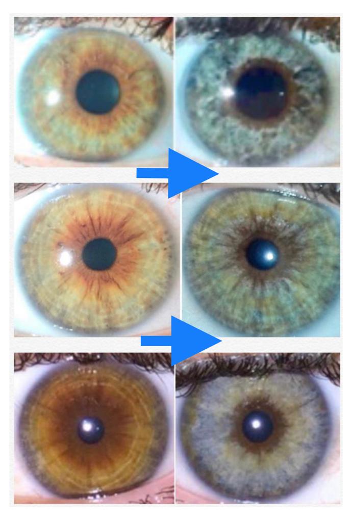 mages of before and after the treatment of eye color change