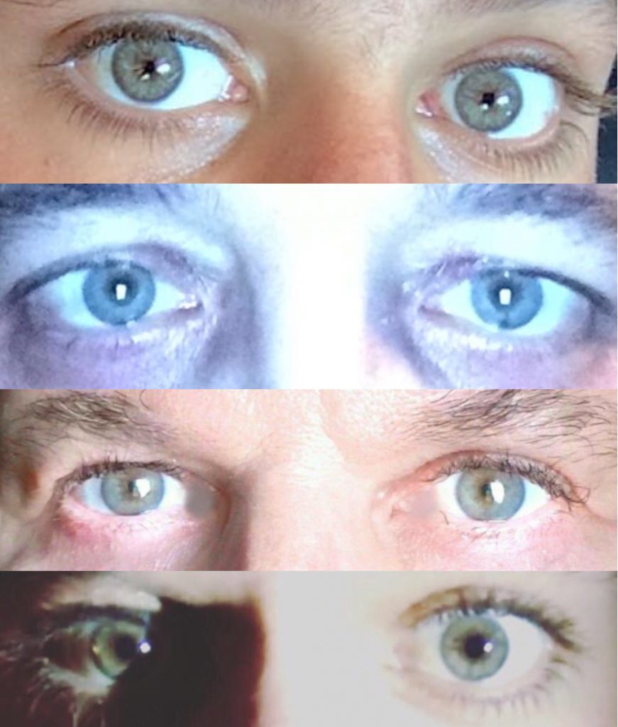 Aparência - Clínica Eyecos - Cambio color de ojos