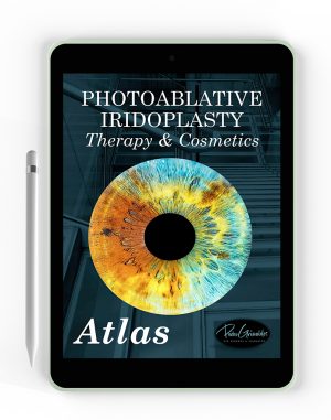 Primer libro Atlas sobre la Iridoplastia Láser (versión pdf)