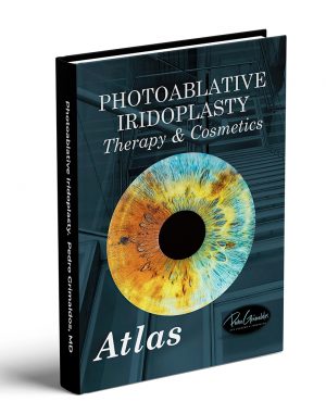 Primer libro Atlas sobre la Iridoplastia Láser (versión impresa)