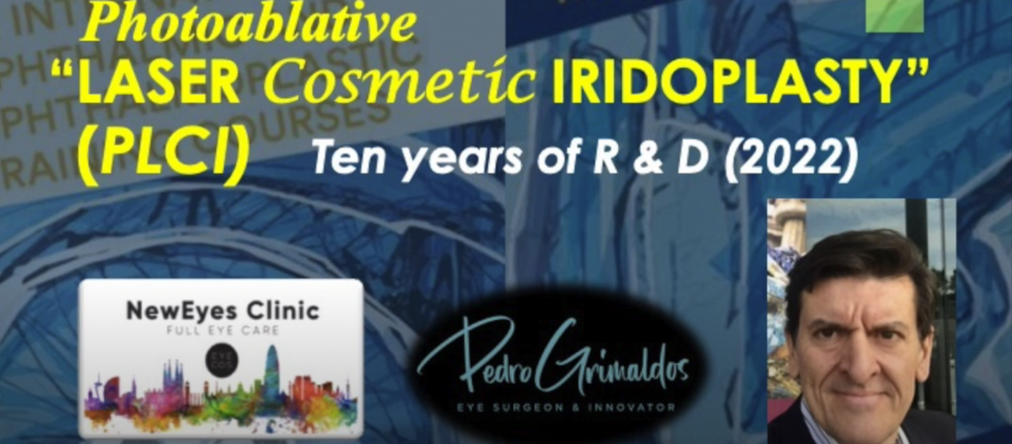 Laser Cosmetic Iridoplasty
