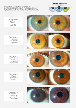 clasificacion-grados-neweyes-clinica-eyecos